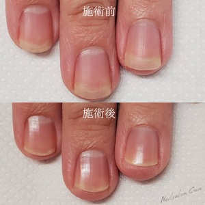 S__2678849