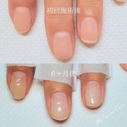 S__3399702