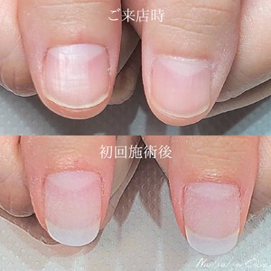 S__3399692