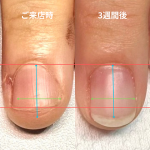見出しを追加 - 3