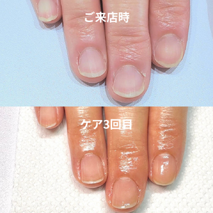 本文を追加 - 2