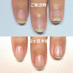 見出しを追加 - 2