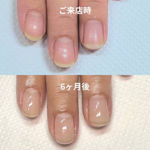 見出しを追加 - 2
