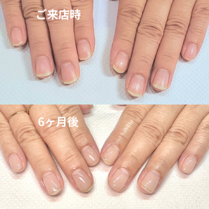見出しを追加 - 1