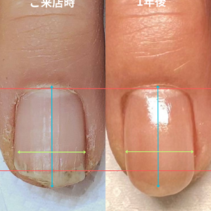 見出しを追加 - 4