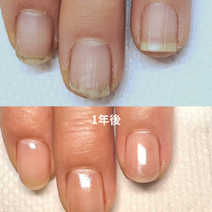 見出しを追加 - 2