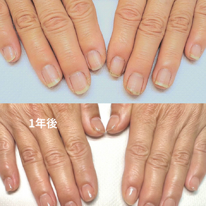 見出しを追加 - 1