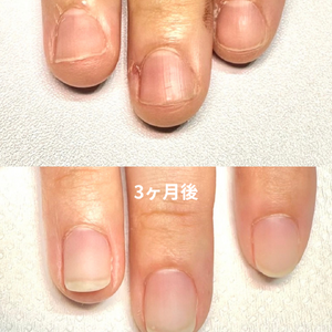 見出しを追加 - 2
