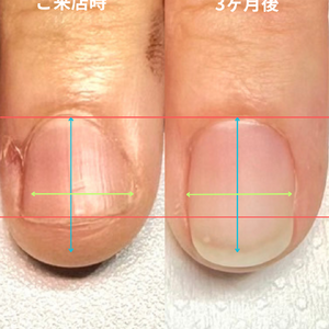 見出しを追加 - 4