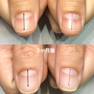 見出しを追加 - 3