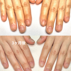 見出しを追加 - 1