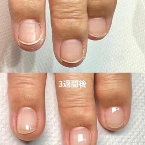 見出しを追加 - 2