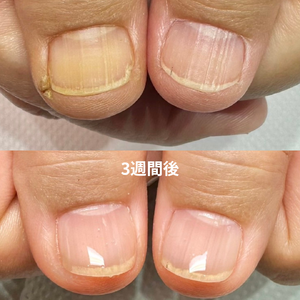 見出しを追加 - 3