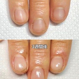 見出しを追加 - 2