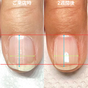 見出しを追加 - 3