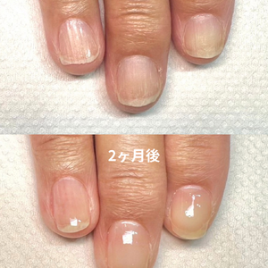 見出しを追加 - 2