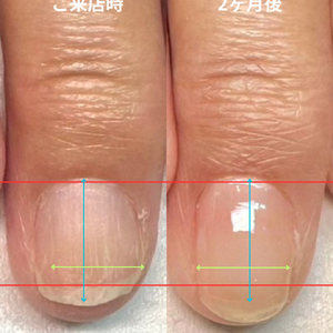 見出しを追加 - 4