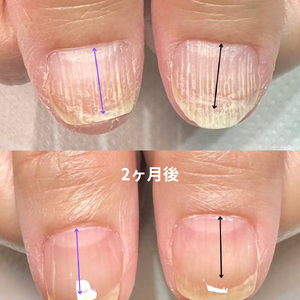 見出しを追加 - 3