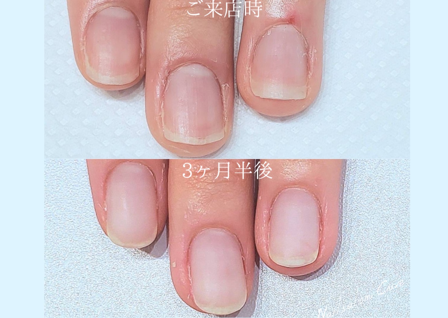 1920石圧縮