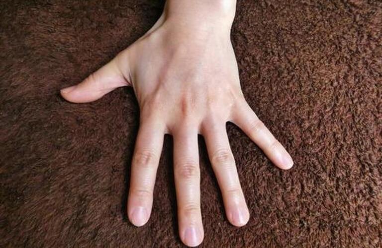 熊谷で噛み爪による深爪にも対応の深爪矯正ネイルサロン｜自爪育成・深爪矯正・巻き爪矯正専門店 Nailsalon Cure