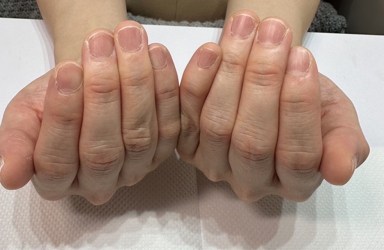 東松山で人気の個室サロンで人目を気にせず深爪育成ができます｜自爪育成・深爪矯正・巻き爪矯正専門店Nailsalon Cure