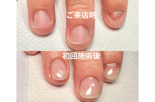 様々な薬剤の中から最適なものを選びます