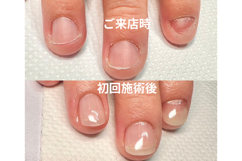 様々な薬剤の中から最適なものを選びます