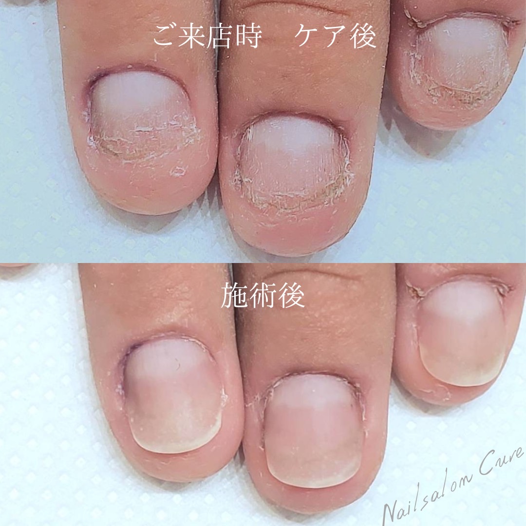 ダウンロード