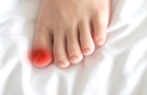 巻き爪にお悩みで巻き爪矯正をしたいなら｜熊谷｜自爪育成・深爪矯正・巻き爪矯正専門店 Nailsalon Cure